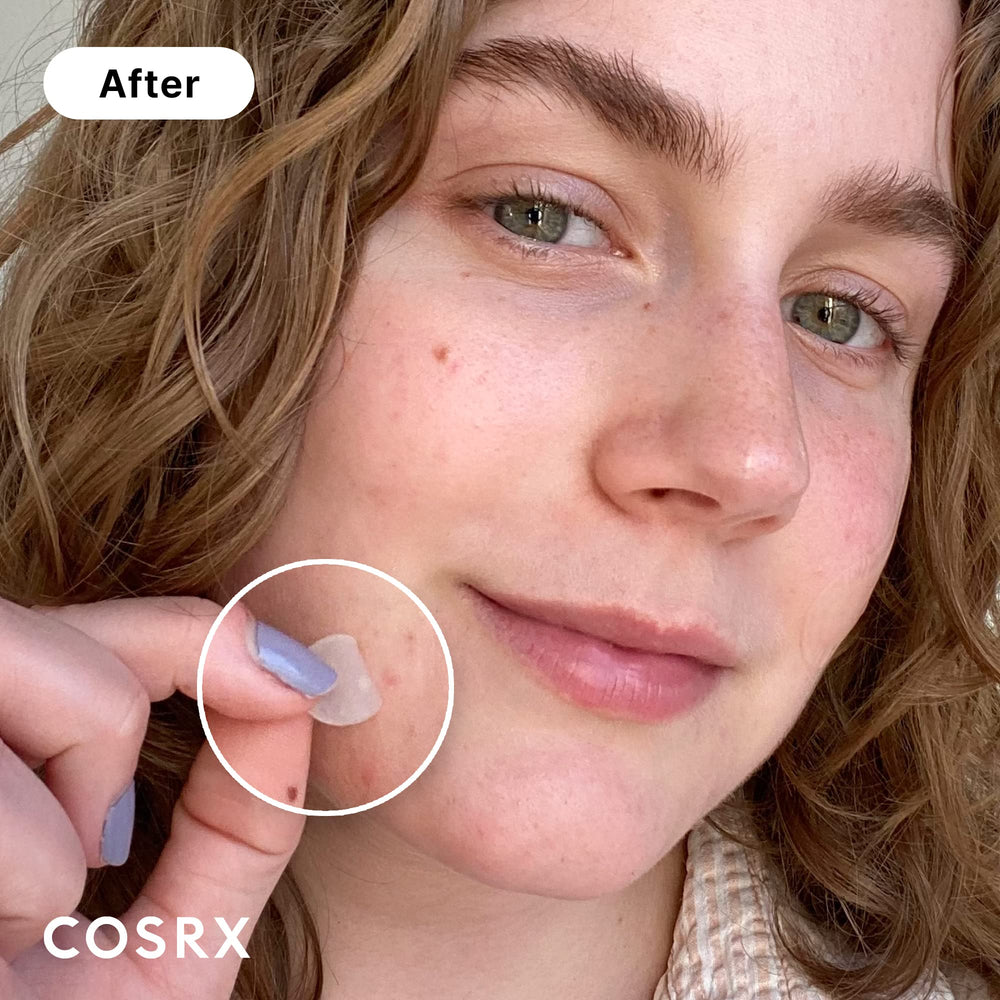 COSRX parche hidrocoloide absorbente para espinillas protege la zona.