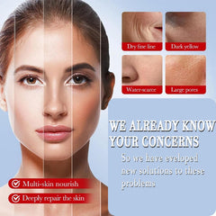 Tratamiento suave para manchas oscuras y melasma con crema de ácido kojico.