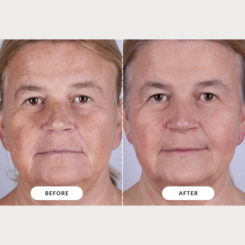CurrentBody mascarilla LED Serie 2, tarjeta NFC Veritace, información personalizada sobre resultados.