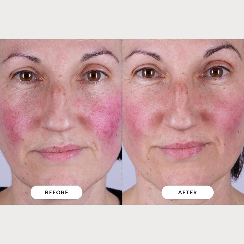 CurrentBody mascarilla LED Serie 2, uso recomendado en rutina de cuidado nocturno.