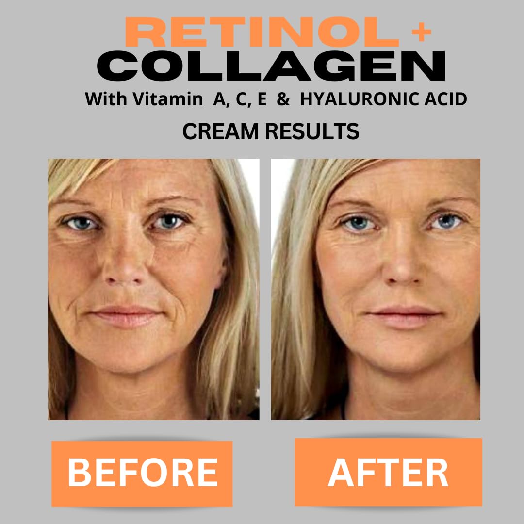 DERMA CLINICALS ácido hialurónico y vitamina C para hidratación y luminosidad