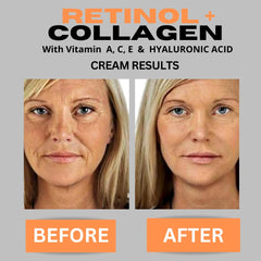 DERMA CLINICALS ácido hialurónico y vitamina C para hidratación y luminosidad