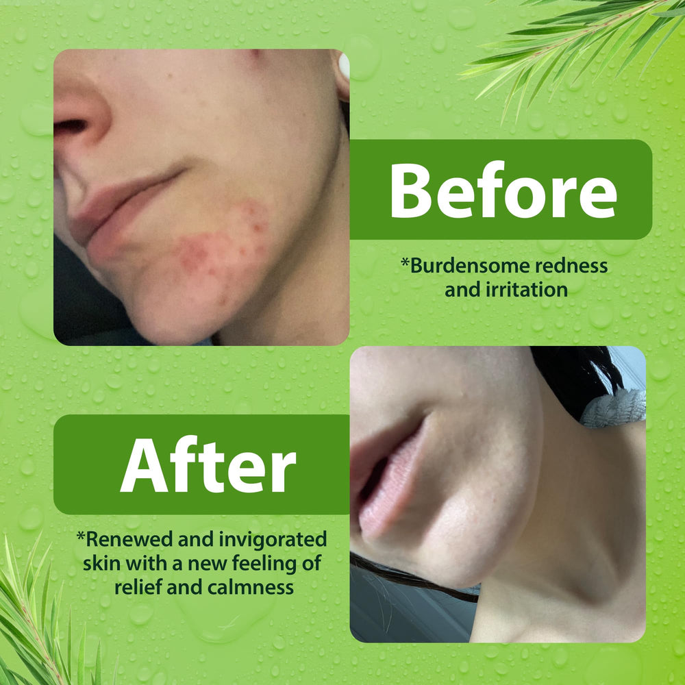 Derma-Nu cuida la piel con ingredientes nutritivos para uso diario.