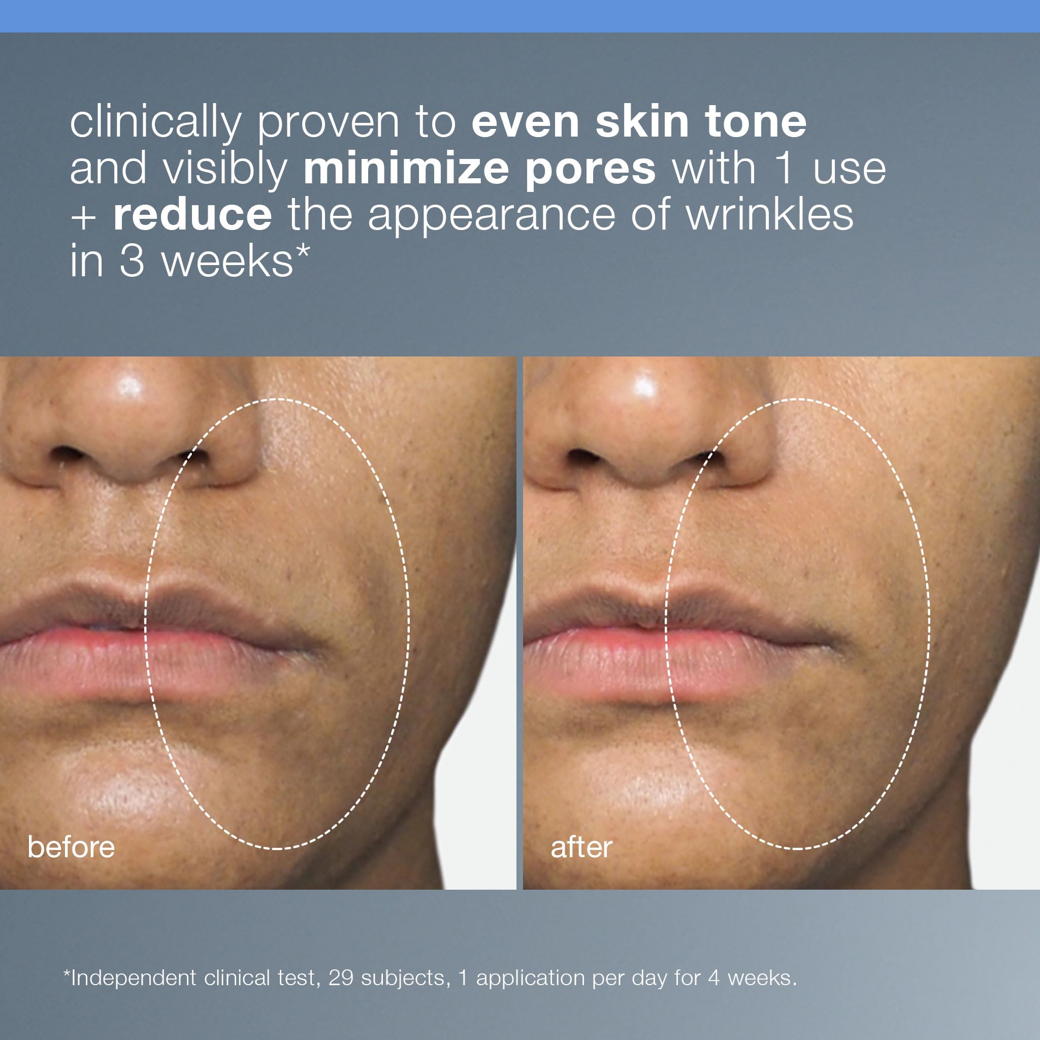 Dermalogica peeling líquido, aplicación nocturna suave sobre la piel para claridad gradual.