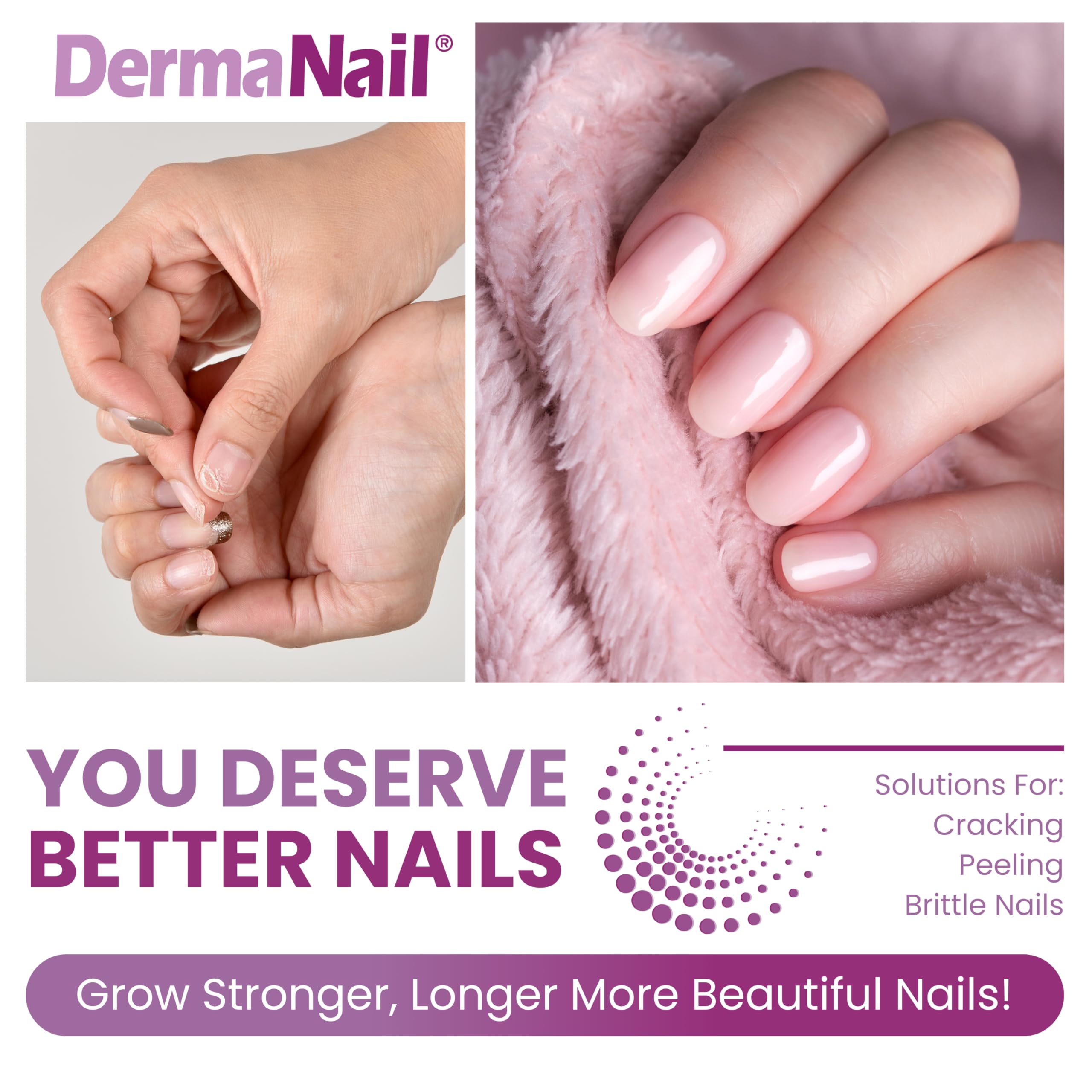 DermaNail crema Cutemol para cutículas, hidratación que cuida.