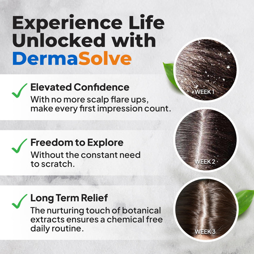 Dermasolve Alivio de psoriasis y dermatitis seborreica en cuero cabelludo.