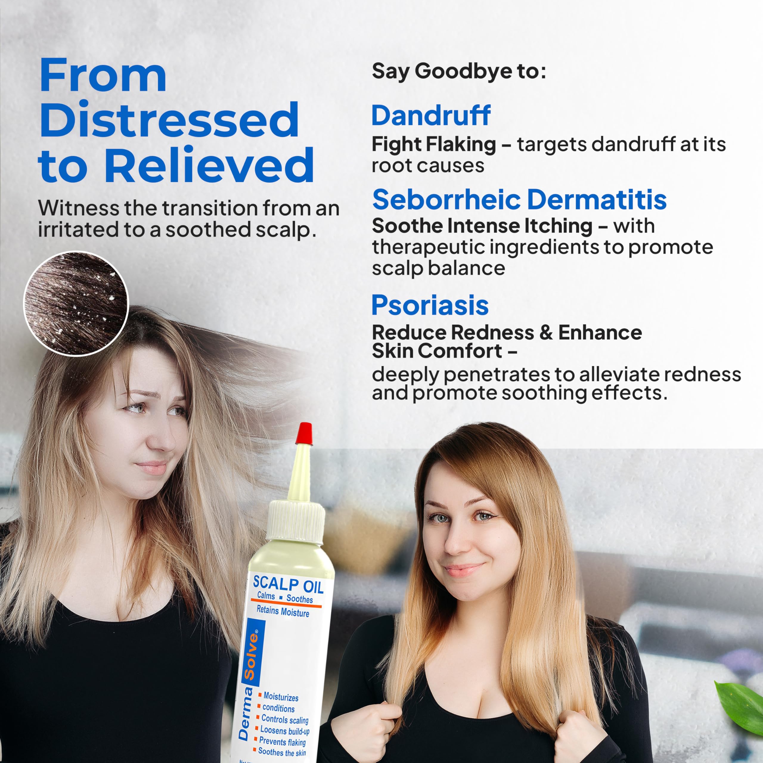 Dermasolve Calendula: hidratación para cuero cabelludo seco.