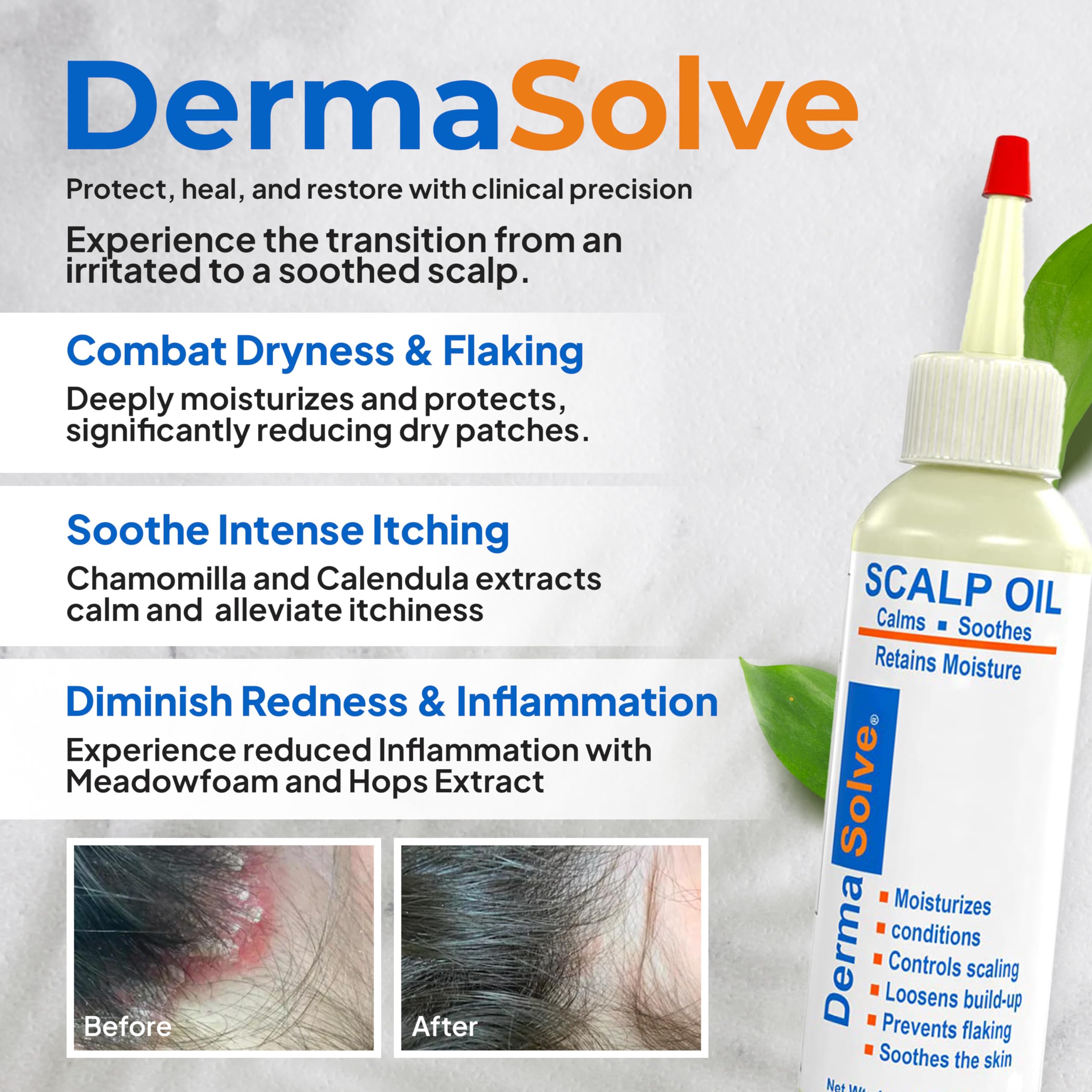 Dermasolve huile apaisante camomille – action douce et apaisante sur le cuir chevelu.
