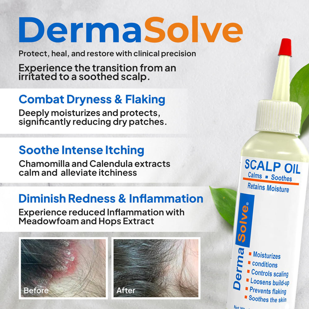 Dermasolve huile apaisante camomille – action douce et apaisante sur le cuir chevelu.