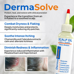 Dermasolve huile apaisante camomille – action douce et apaisante sur le cuir chevelu.