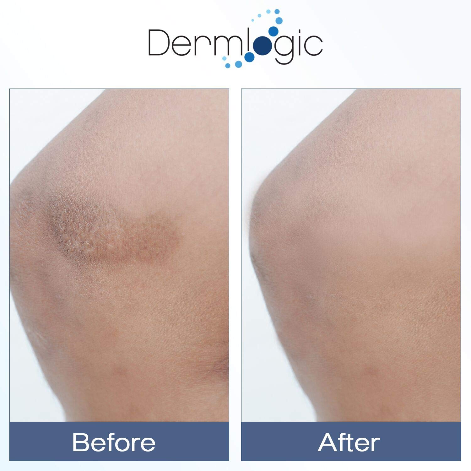 Dermlogic Vitamine K Crème avec acide hyaluronique: hydrate durablement la peau.