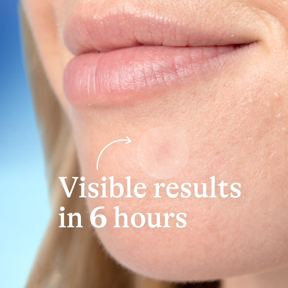 Differin Acne Patches being applied during daytime, invisible under makeup