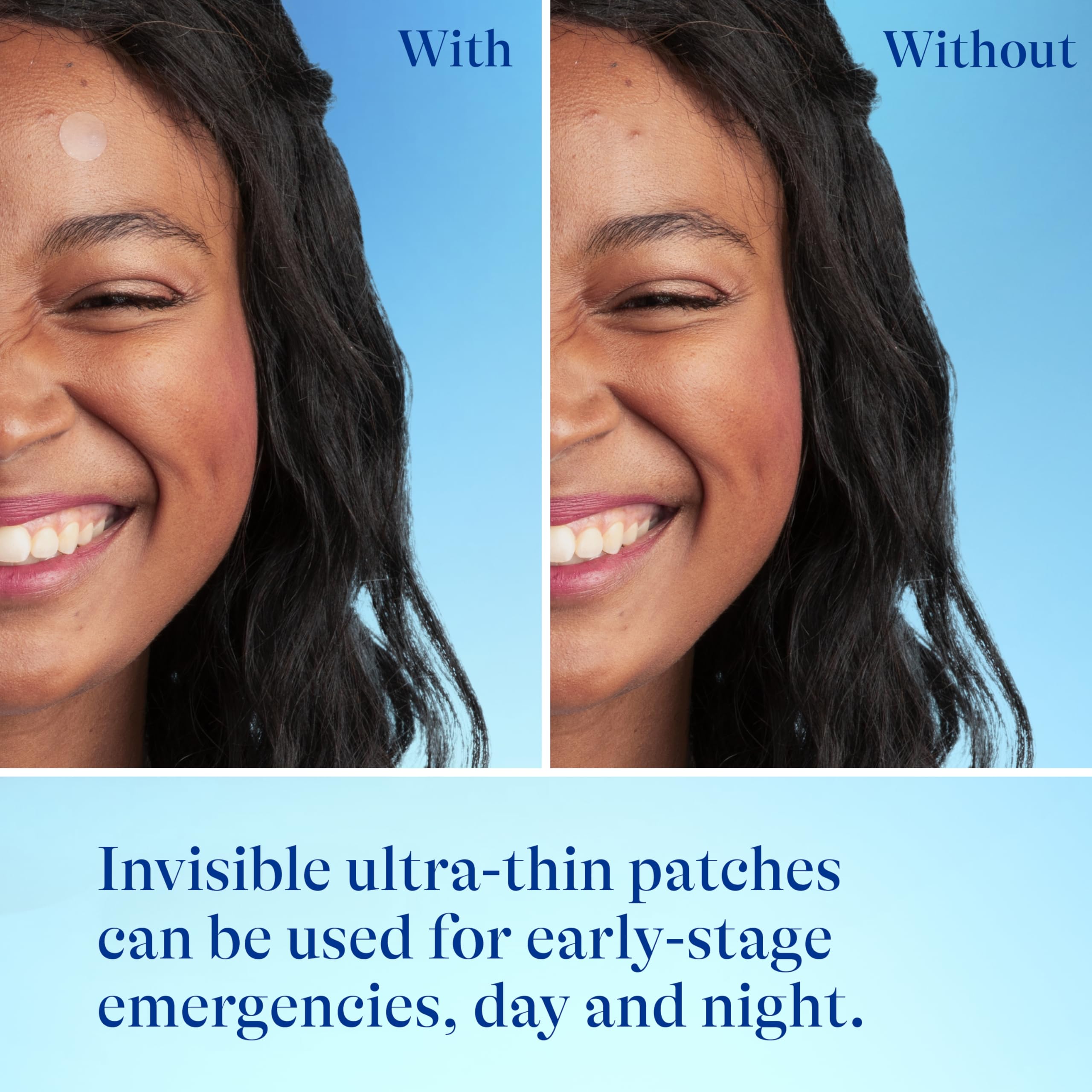 Differin Acne Patches small patch for precise spot coverage