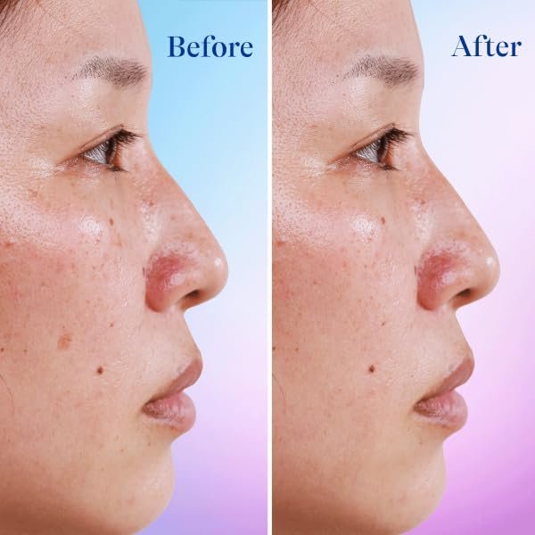 Differin Serum en envase de 1 oz para la rutina diaria.