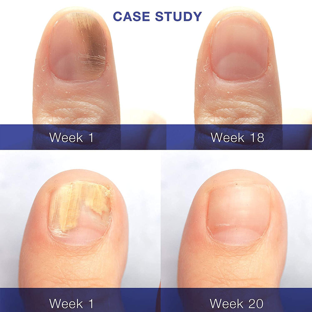 Dr. Luke Nail Repair Liquid se aplica en cutículas para cuidado suave.
