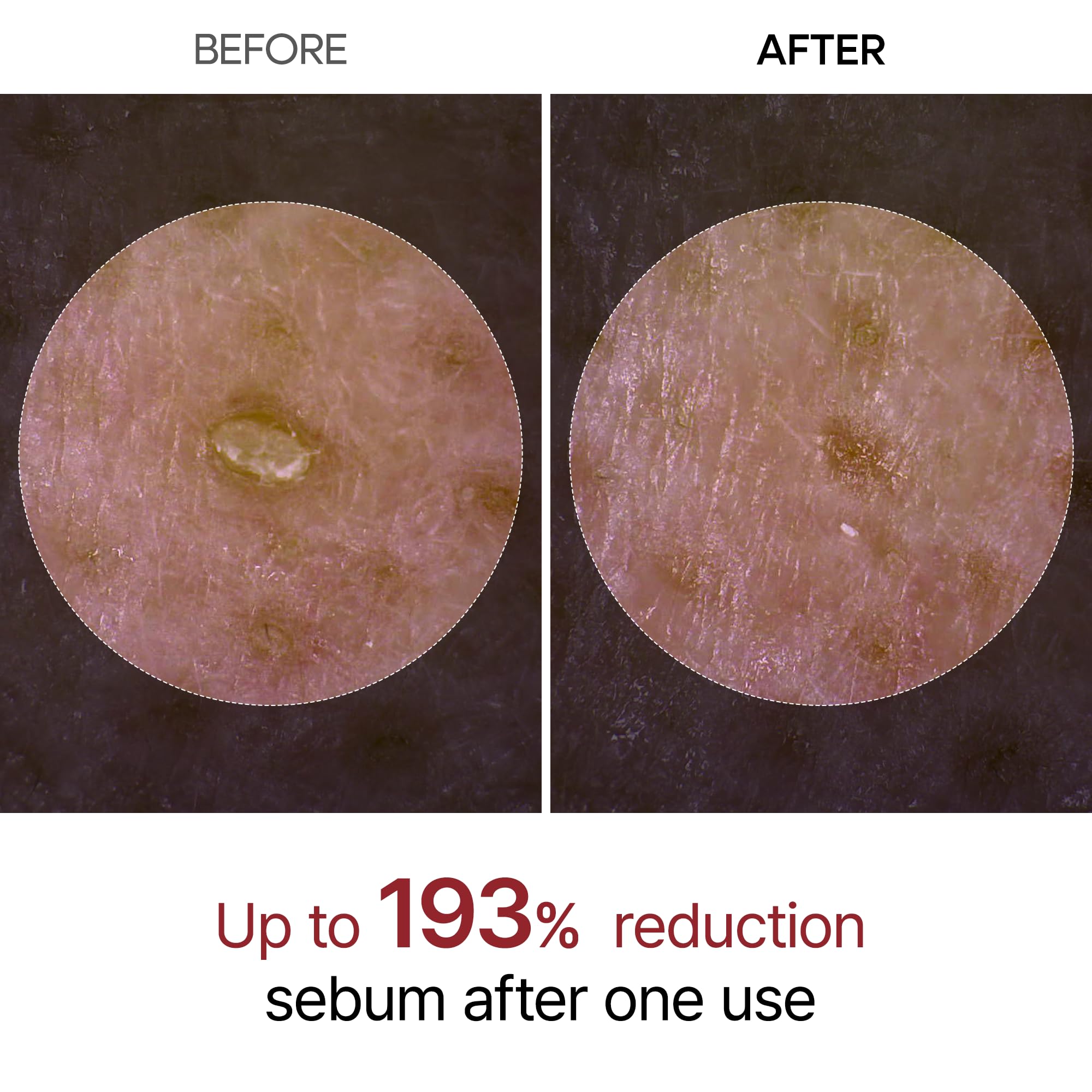 Dr.Melaxin Peel Shot Glow: exfoliante-suero de arroz para renovación suave.