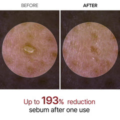 Dr.Melaxin Peel Shot Glow, poros visibles reducidos gracias a su fórmula suave