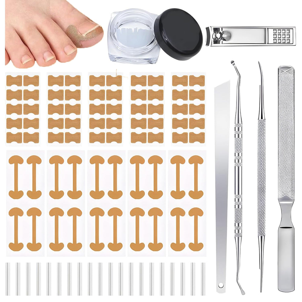 DreamCatching corrector de uñas encarnadas: conjunto para corrección precisa y alivio diario