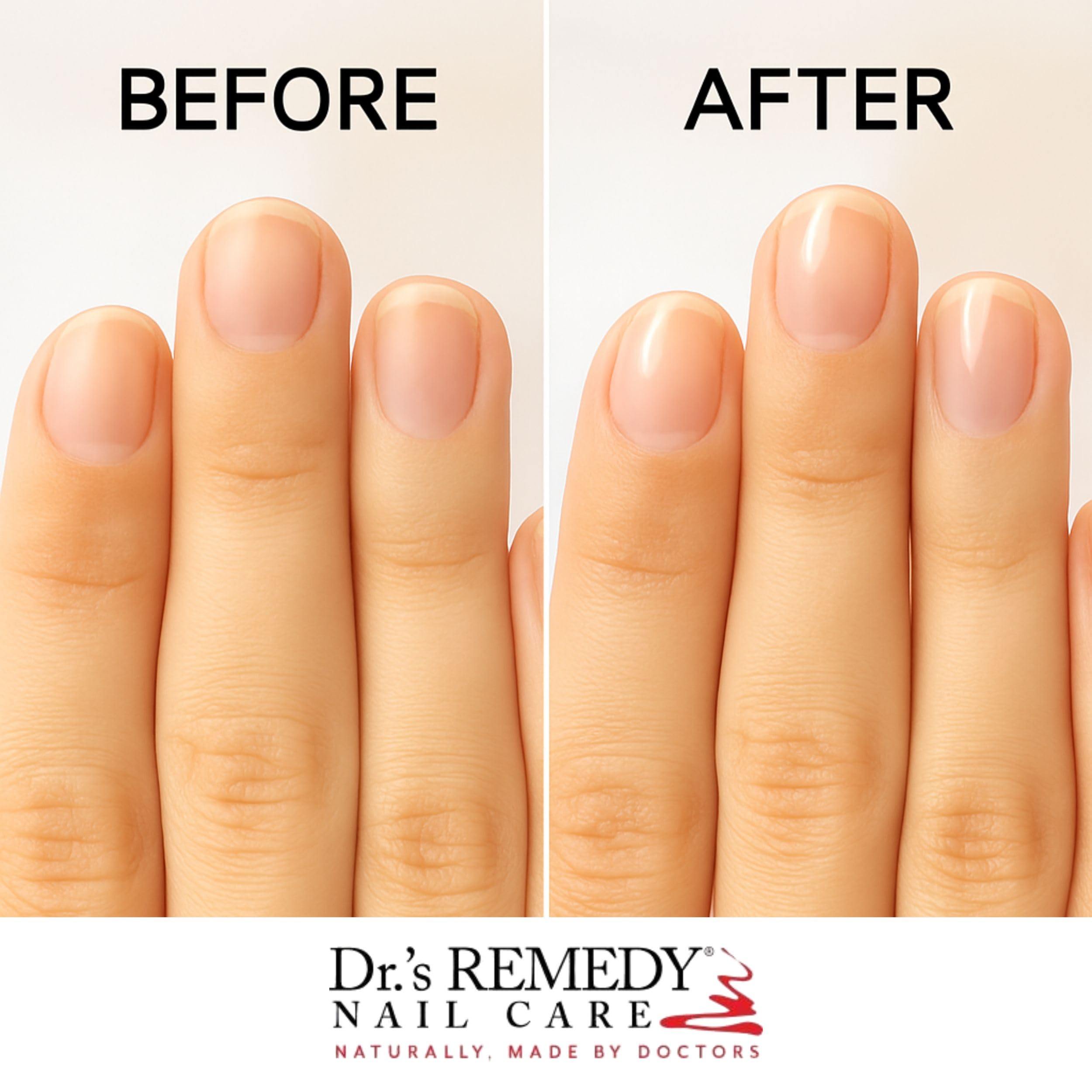 Dr.'s Remedy Total protege uñas con hidratación y protección UV.