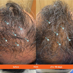 Revita Shampoo espuma ligera, experiencia de lavado refrescante y agradable.