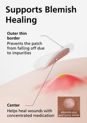 EasyDerm two-size options 10mm-12mm for precise fit