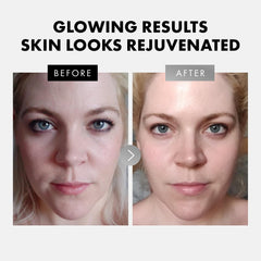 Eclat Skincare ácido hialurónico: hidrata profundamente y aporta firmeza.