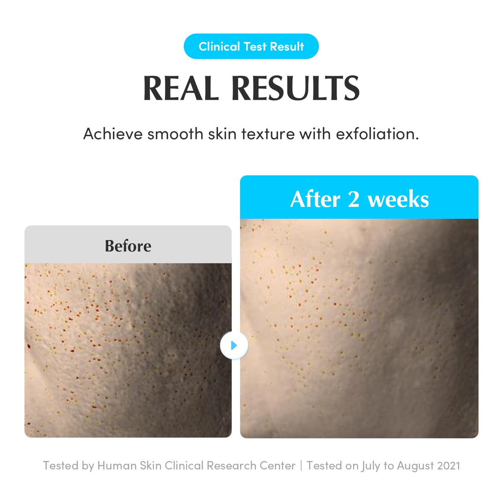 EQQUALBERRY Tónico poros visibles reducidos con exfoliación suave.