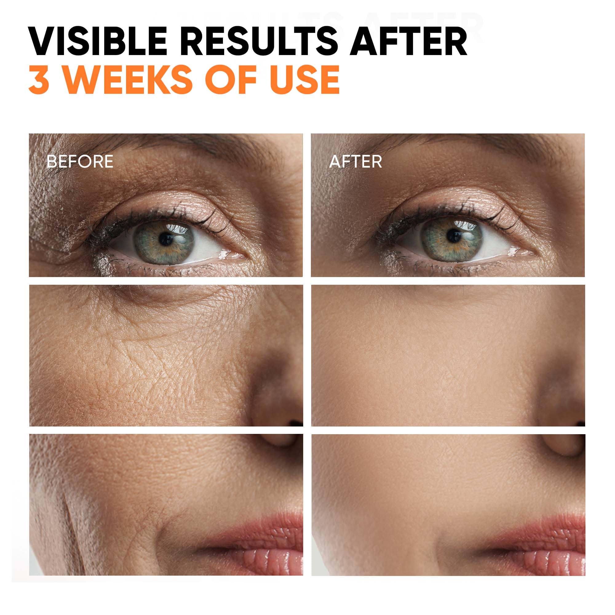 EVERYOUTH Sérum Retinol y retinal, exfolia suavemente para un tono más uniforme.