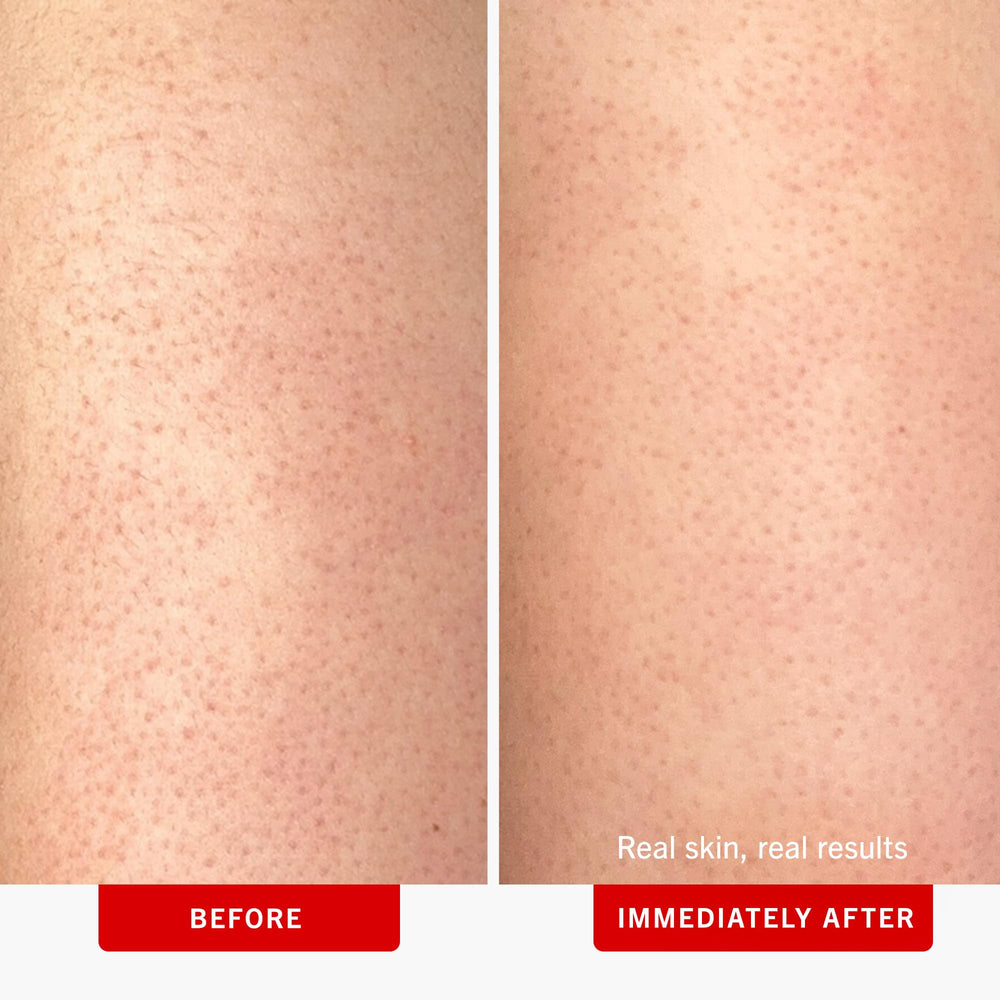 FAB pack de dos exfoliantes corporales para cuidado de KP