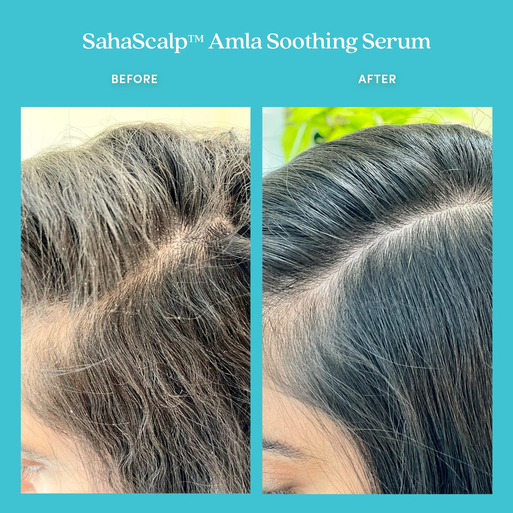 Fable & Mane Amla Serum, aroma suave de grosella negra, rosa y azahar