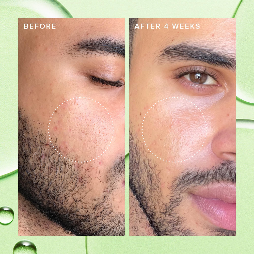 Exfoliación suave diaria gracias a enzimas de papaya para piel clara.