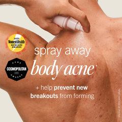 First Aid Beauty: acné corporal con 2% salicílico en espalda y pecho