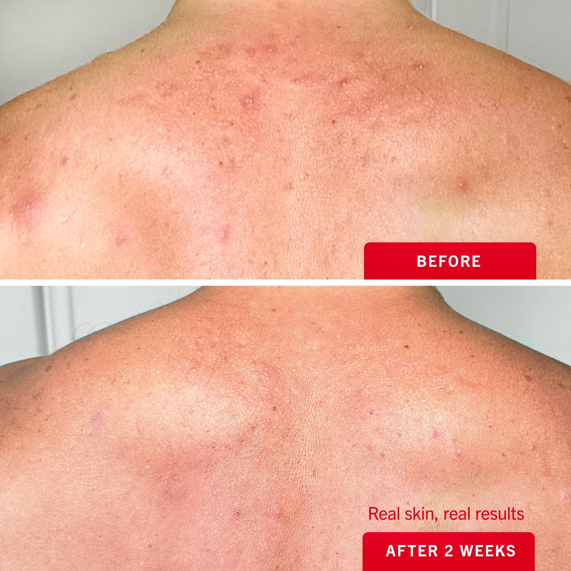 First Aid Beauty: aplicación fácil en áreas difíciles de alcanzar