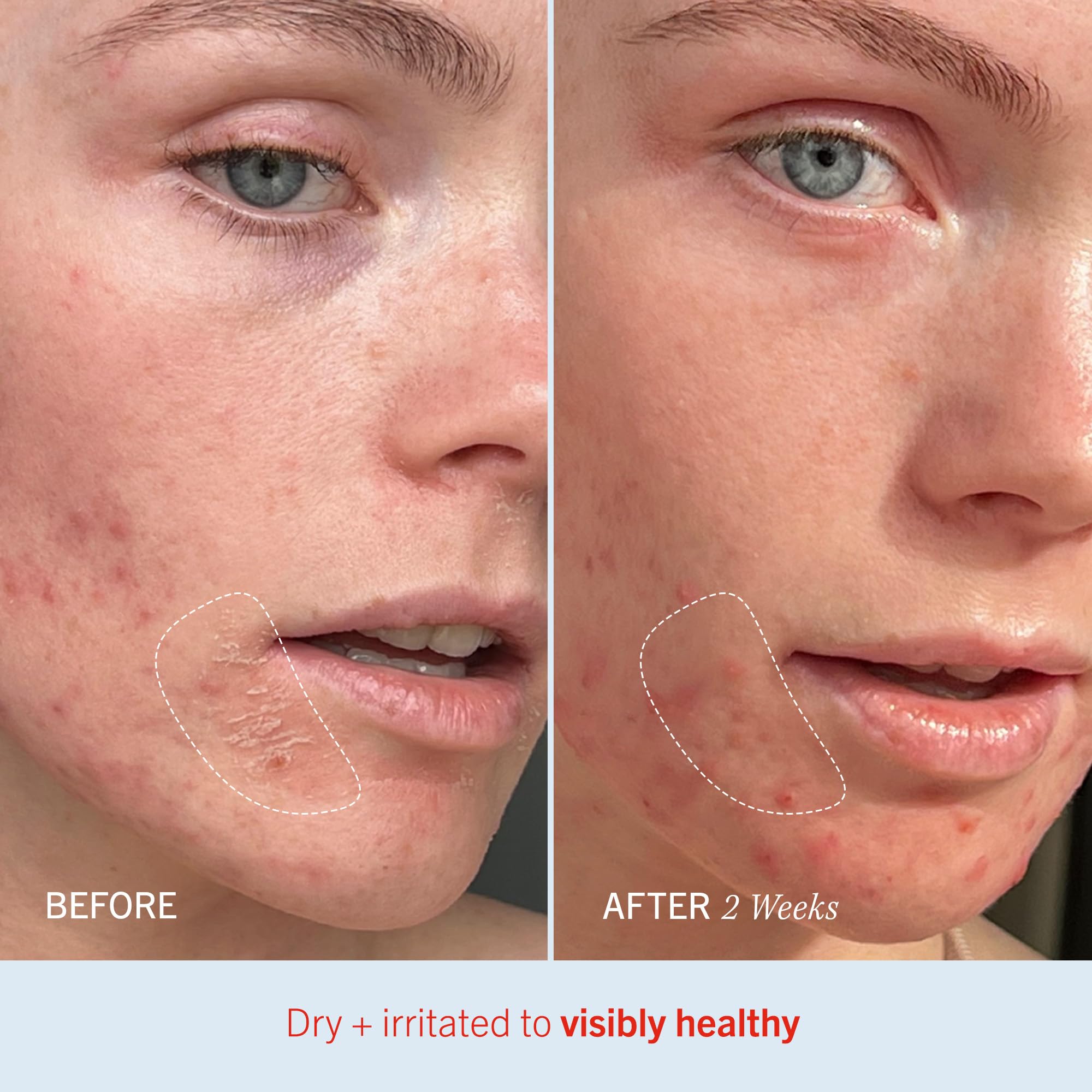 Absorción rápida de Ultra Repair Cream sin sensación grasa de First Aid Beauty