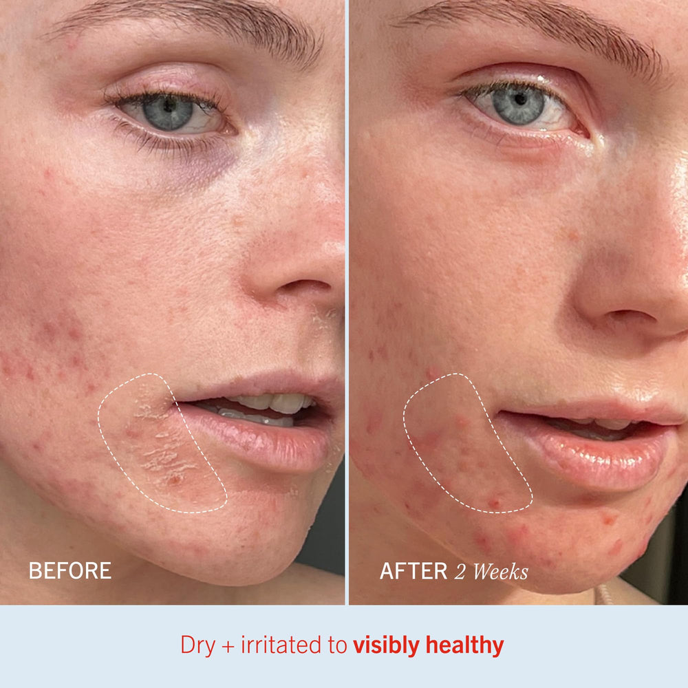 Absorción rápida de Ultra Repair Cream sin sensación grasa de First Aid Beauty