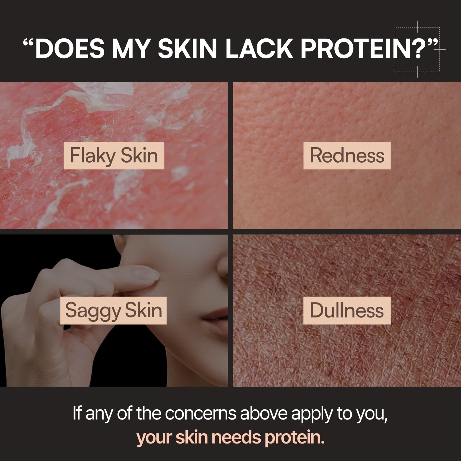 FLASKIN Tónico Lechoso ayuda a sostener la barrera cutánea.