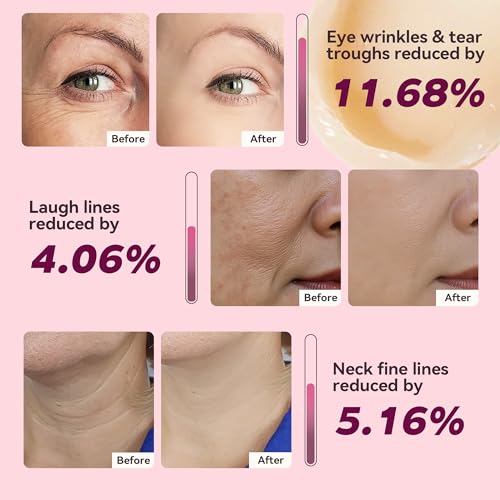 Fleur Luxxe Calcium Multi Balm ojos: hidratación y soporte para zonas sensibles.