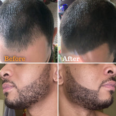 FOLLICLE BOOSTER cepillo-barba para peinado rápido y definido.
