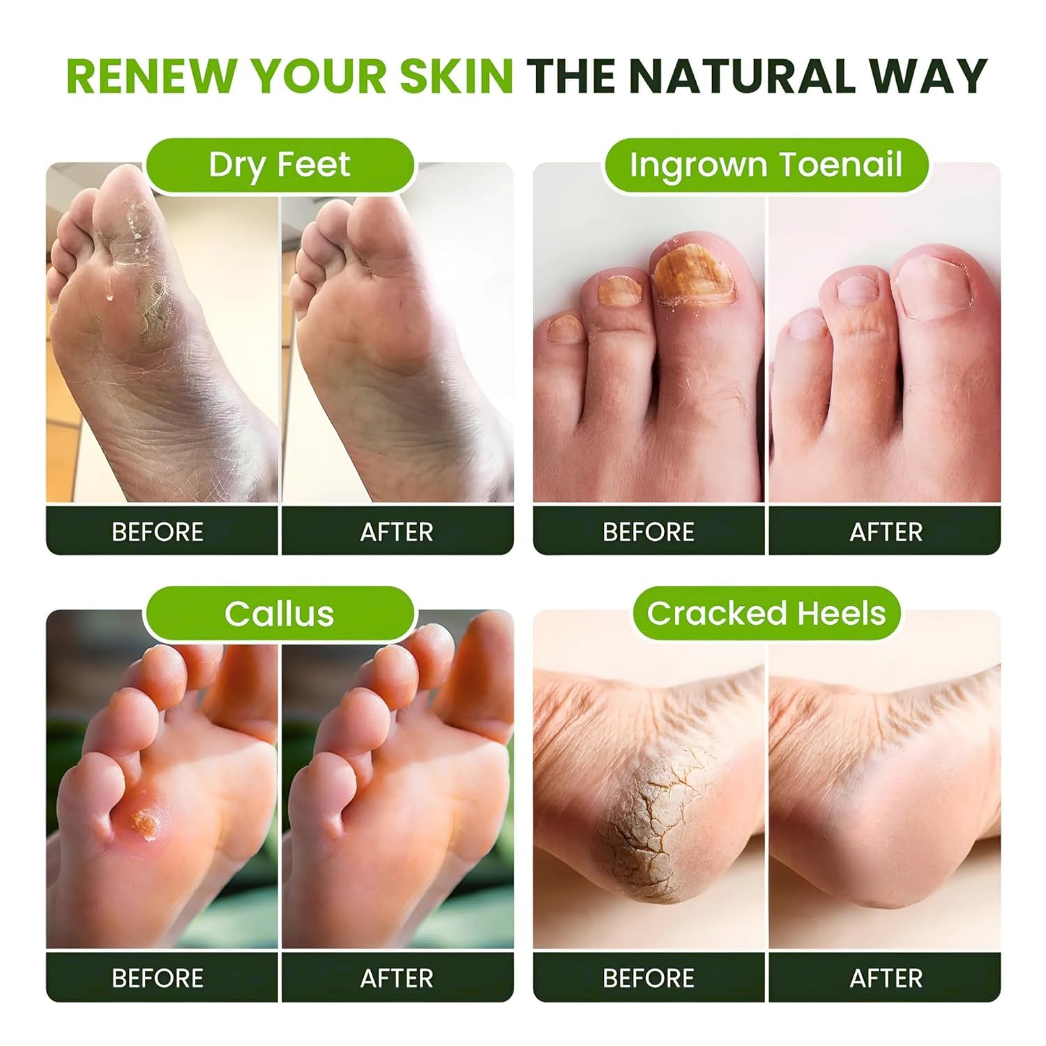 Foot Cure: cuidado de pies sensibles con fórmula suave