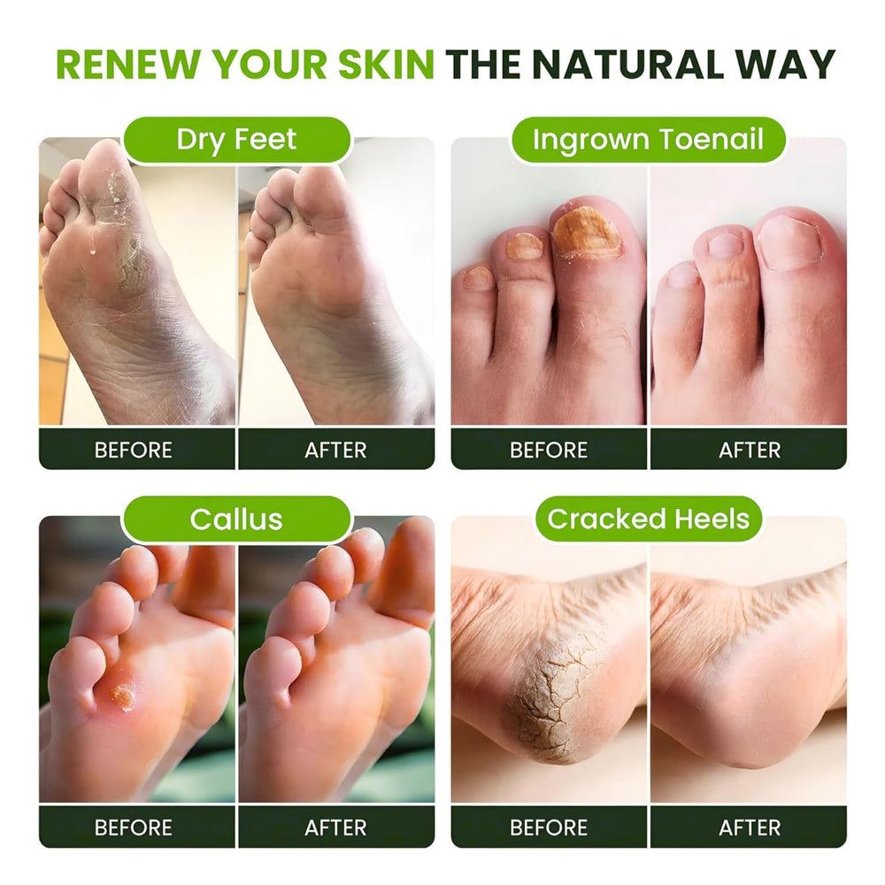 Foot Cure: cuidado de pies sensibles con fórmula suave