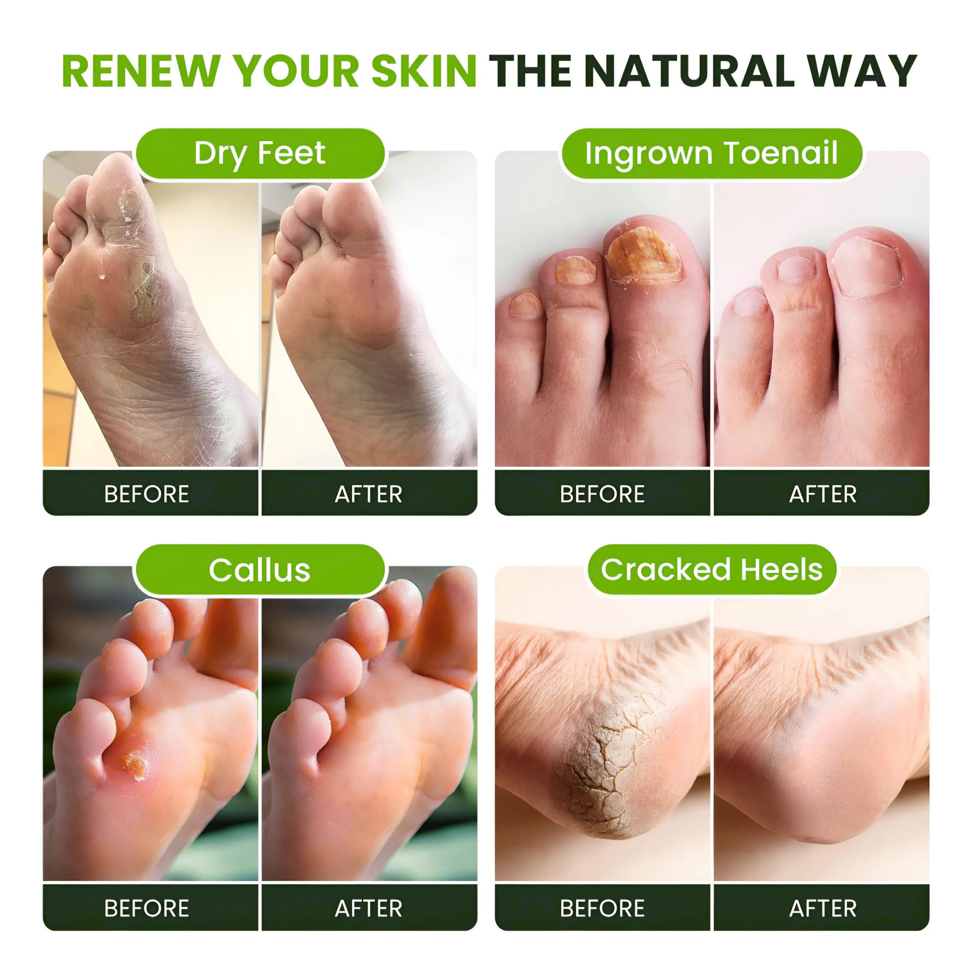 Foot Cure: piel de pies suave tras el baño