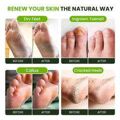 Foot Cure: piel de pies suave tras el baño
