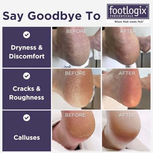 Footlogix mango gomoso, agarre cómodo para un pulido seguro