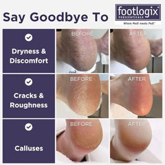 Footlogix mango gomoso, agarre cómodo para un pulido seguro