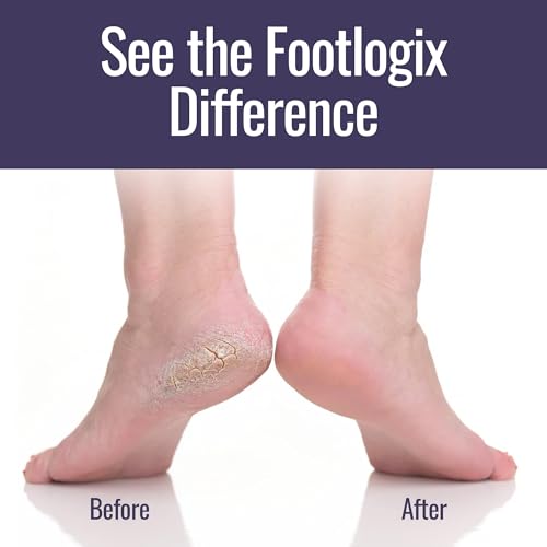 Footlogix talones secos muestra el estado previo al tratamiento