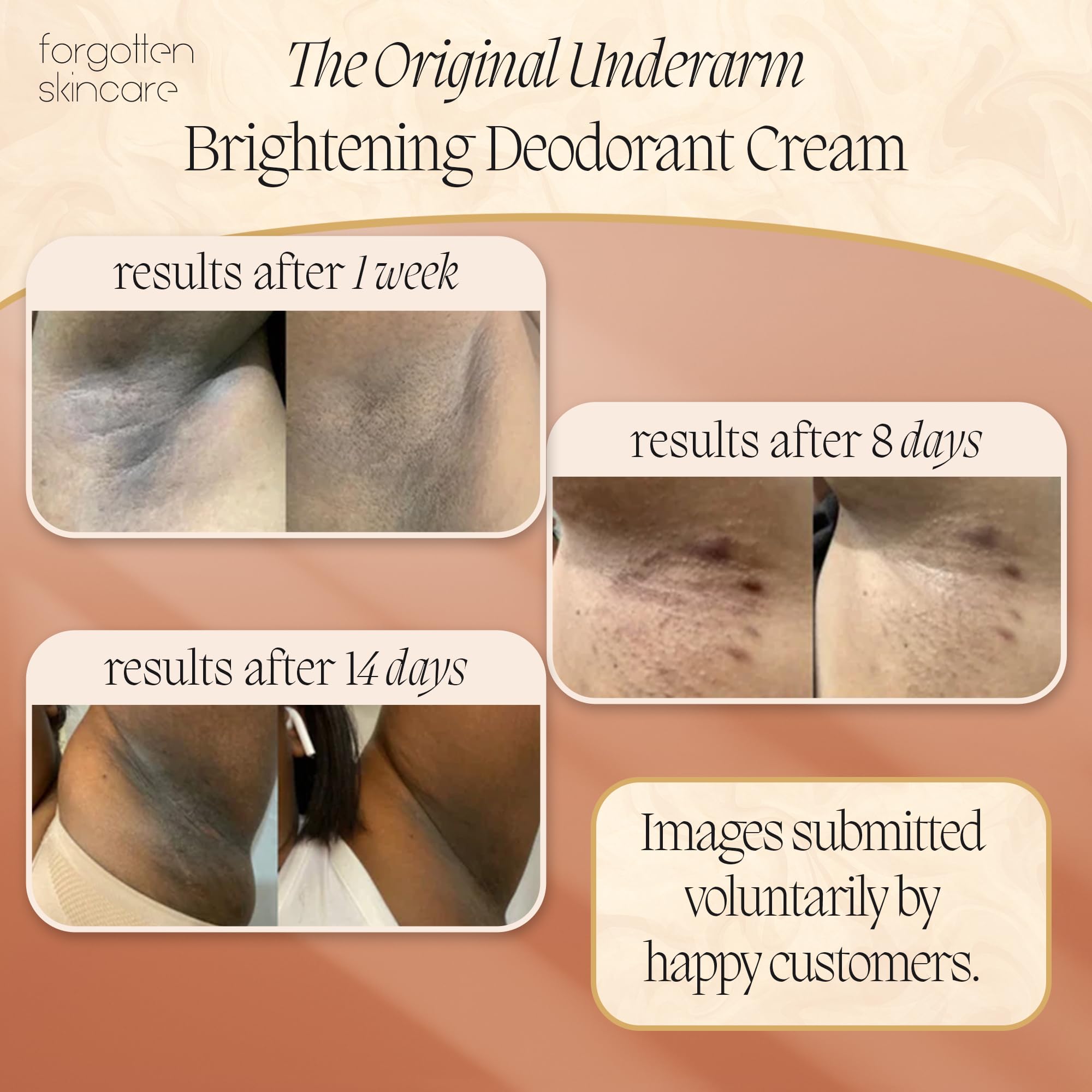 Forgotten Skincare axilas-vitamina C: ingrediente clave para iluminación gradual.