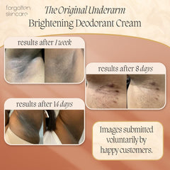 Forgotten Skincare axilas-vitamina C: ingrediente clave para iluminación gradual.