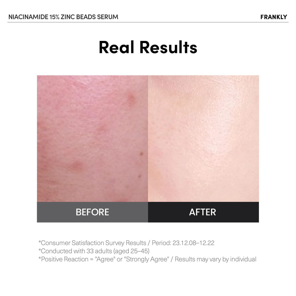 FRANKLY Niacinamida 15% + Zinc, aplicación suave del serum para textura uniforme