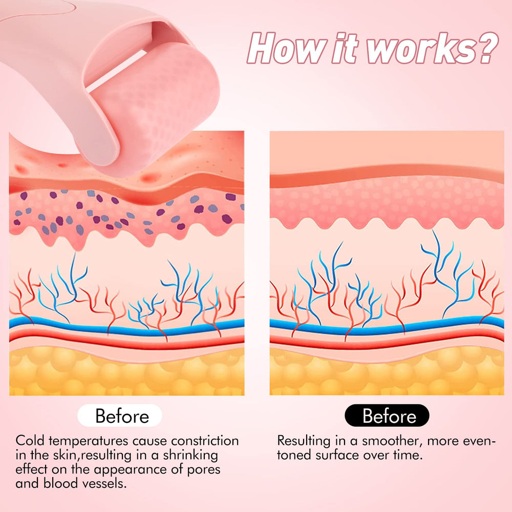 Rodillo de hielo Fronnor para cuello relaja músculos y reduce tensión.