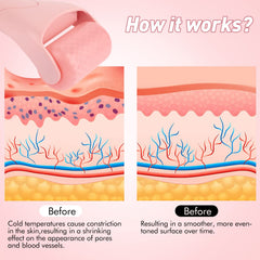 Rodillo de hielo Fronnor para cuello relaja músculos y reduce tensión.